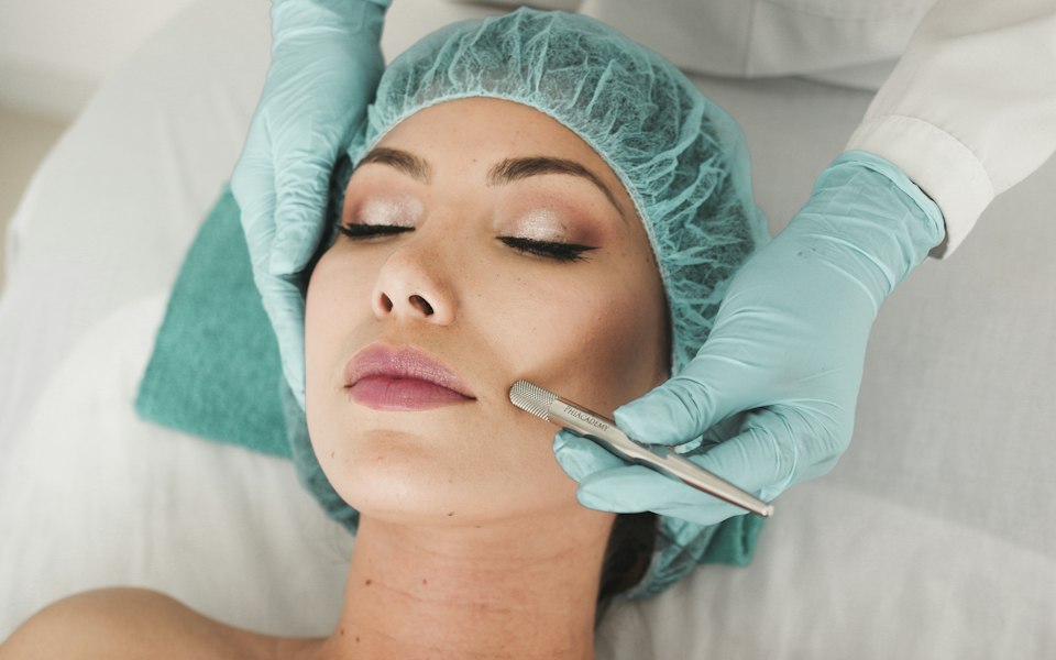 Acne scar treatment
