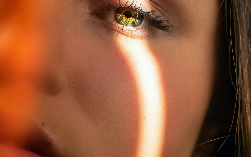 Laser toning for pigmentation & tan